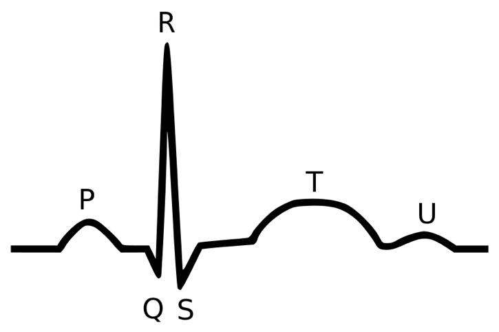 Diagram of an EKG tracing with parts labeled