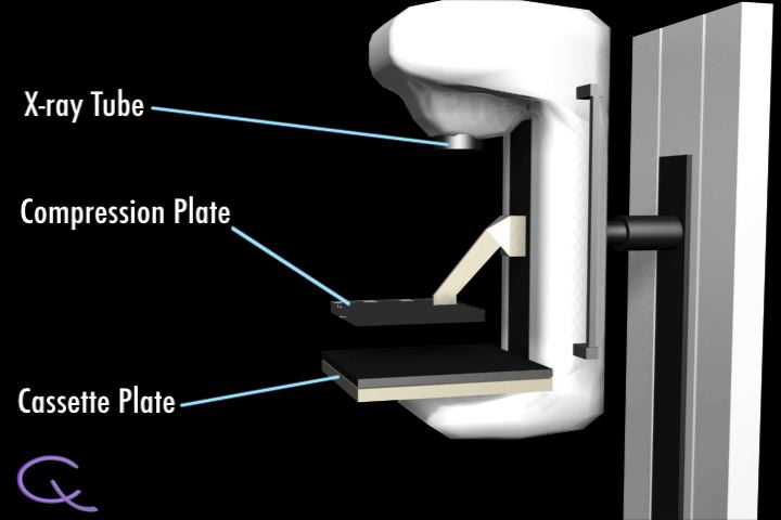 Mammography Machine mammogram