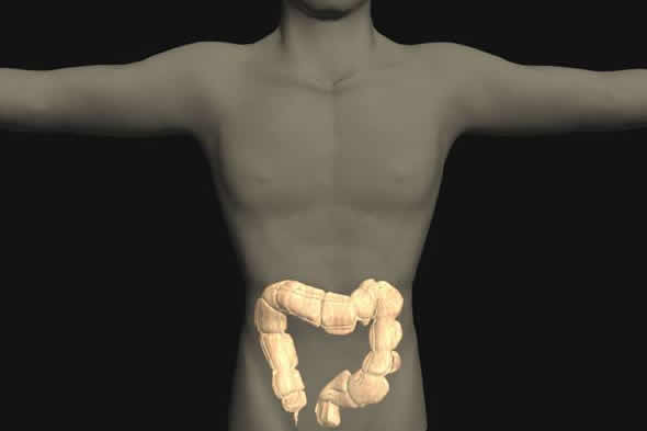 Colon and Rectal Cancer | CancerQuest