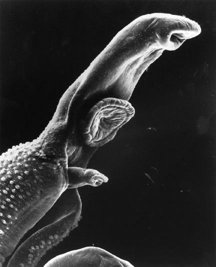 electron micrograph of schistosome parasite