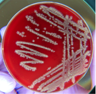 Bacillus Licheniformis.png