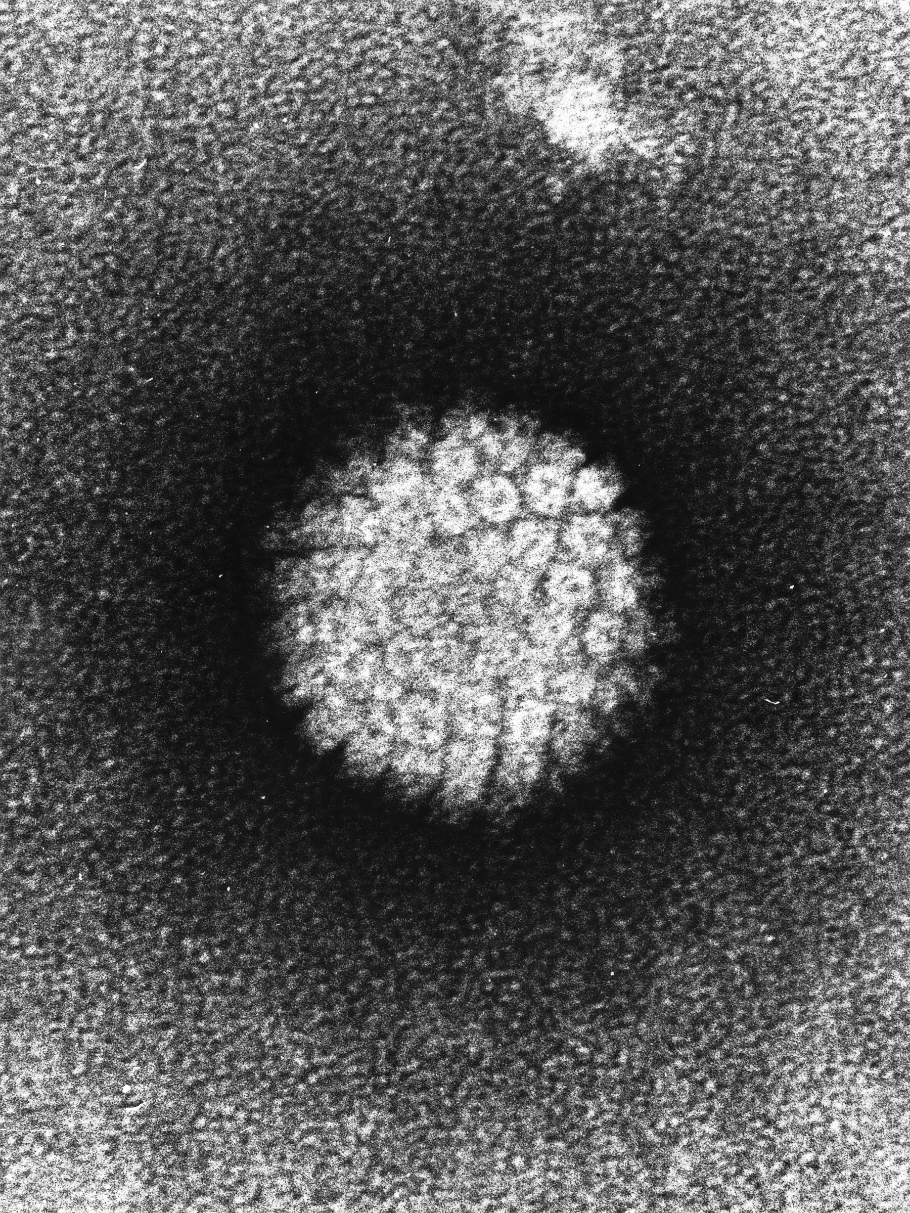 HPV virion viewed with electron microscope