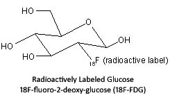 structure of 18F-FDG radioactively labeled glucose structure