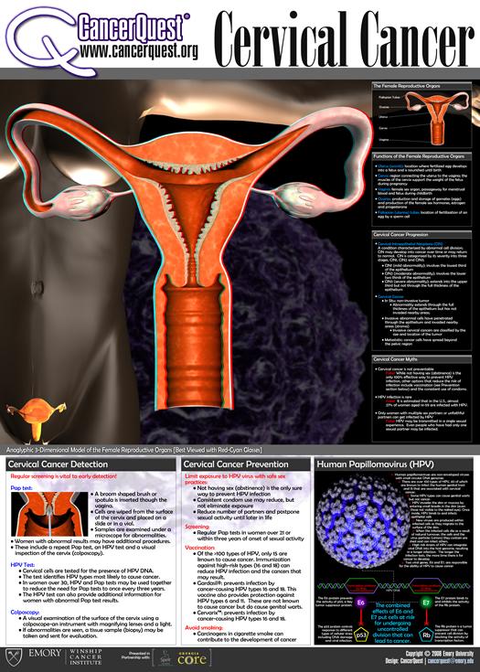 Cervical Cancer Poster 3d poster