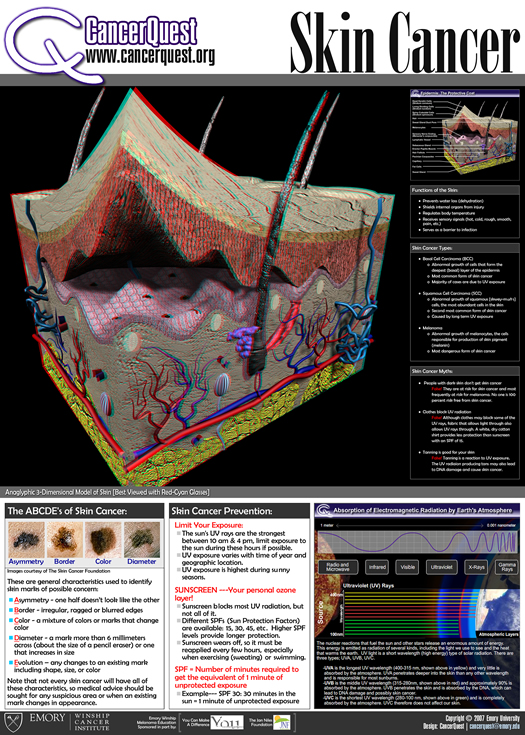 Skin Cancer Poster 3d poster