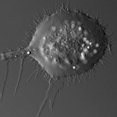 Non-Small Cell Lung Cancer Cell