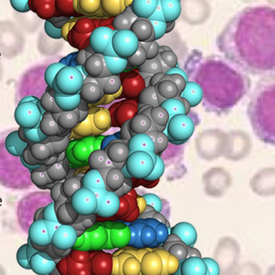 Leukemia cells with a model of DNA superimposed over them