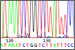 'Junk' DNA found to be highly expressed in cancer cells.