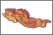 Possible Link Between Nitrate/Nitrite Salts In Processed Meat And Pancreatic Cancer?