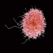  Image of colorized natural killer cell.