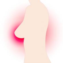 A breast in profile, surrounded by red - indication of cancer