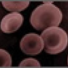 Red Blood Cells As Camouflage For Cancer Treatment.