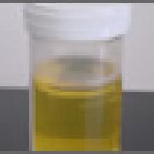 Urine Test To Detect Prostate Cancer