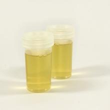 urine samples in plastic vials